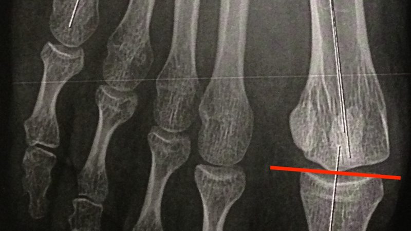 家用轿车轮胎更换周期：如何科学判断**